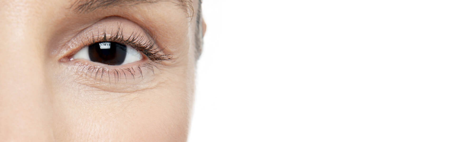 Atopic Skin True Vs False Hero